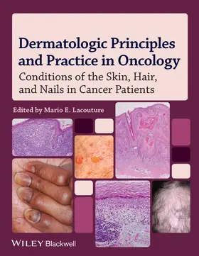 Lacouture |  Dermatologic Principles and Practice in Oncology | Buch |  Sack Fachmedien