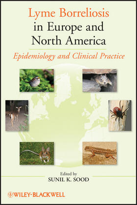 Sood |  Lyme Borreliosos in Europe and North America | Buch |  Sack Fachmedien