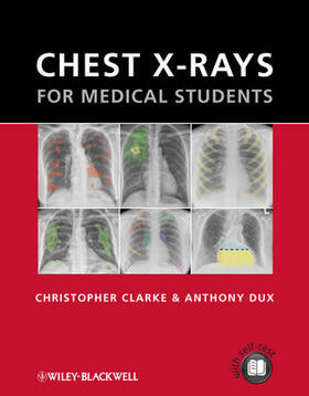Clarke / Dux |  Chest X-rays for Medical Students | Buch |  Sack Fachmedien