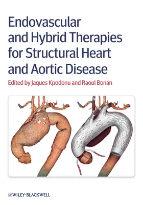 Kpodonu / Bonan |  Endovascular and Hybrid Therapies for Structural Heart and Aortic Disease | Buch |  Sack Fachmedien