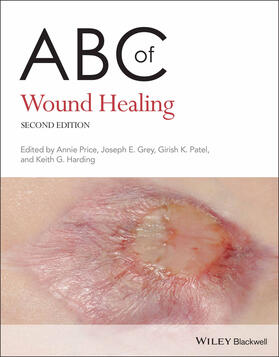 Price / Patel / Grey |  ABC of Wound Healing | Buch |  Sack Fachmedien