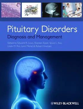 Laws / Ezzat / Asa |  Pituitary Disorders | Buch |  Sack Fachmedien