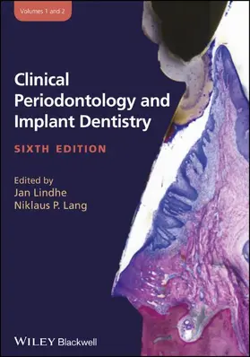 Lindhe / Lang |  Clinical Periodontology and Implant Dentistry, 2 Volume Set | Buch |  Sack Fachmedien