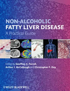 Farrell / McCullough / Day |  Non-Alcoholic Fatty Liver Disease | Buch |  Sack Fachmedien