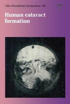 Nugent / Whelan |  Human Cataract Formation | eBook | Sack Fachmedien