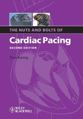 Kenny |  The Nuts and Bolts of Cardiac Pacing | eBook | Sack Fachmedien
