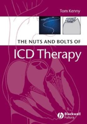 Kenny |  The Nuts and Bolts of ICD Therapy | eBook | Sack Fachmedien