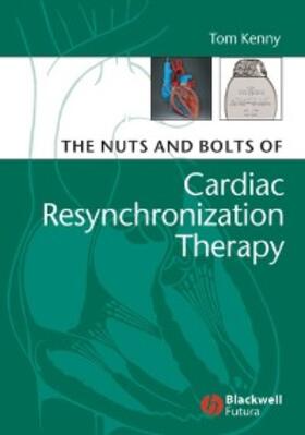Kenny |  The Nuts and Bolts of Cardiac Resynchronization Therapy | eBook | Sack Fachmedien
