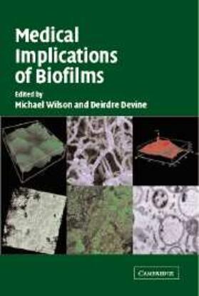 Wilson |  Medical Implications of Biofilms | eBook | Sack Fachmedien