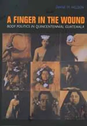 Nelson |  A Finger in the Wound - Body Politics in Quincentennial Guatemala (Paper) | Buch |  Sack Fachmedien