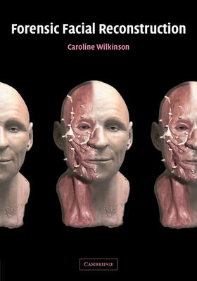 Wilkinson |  Forensic Facial Reconstruction | Buch |  Sack Fachmedien