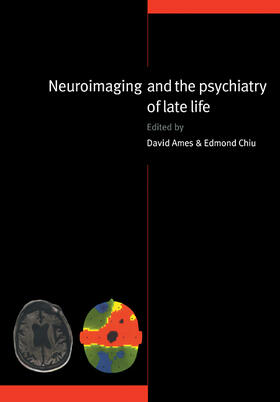 Ames / Chiu |  Neuroimaging and the Psychiatry of Late Life | Buch |  Sack Fachmedien