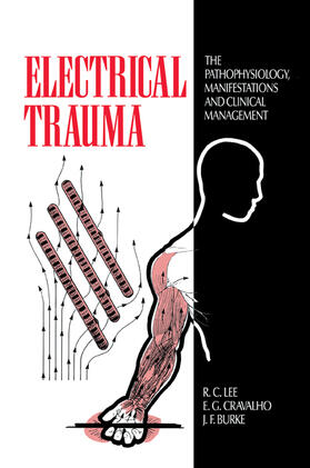 Burke / Lee / Cravalho |  Electrical Trauma | Buch |  Sack Fachmedien