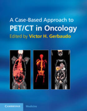 Gerbaudo |  A Case-Based Approach to Pet/CT in Oncology | Buch |  Sack Fachmedien