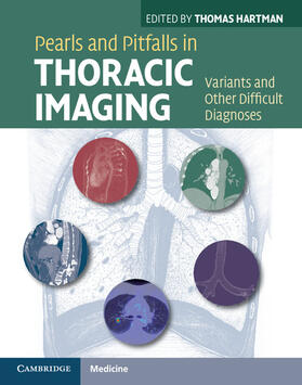 Hartman |  Pearls and Pitfalls in Thoracic Imaging | Buch |  Sack Fachmedien