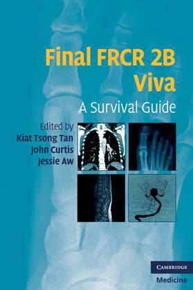 Tan / Curtis / Aw |  Final FRCR 2B Viva | Buch |  Sack Fachmedien