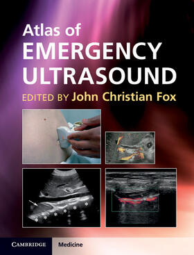 Fox |  Atlas of Emergency Ultrasound | Buch |  Sack Fachmedien