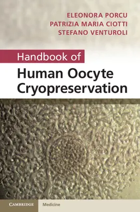 Porcu / Ciotti / Venturoli |  Handbook of Human Oocyte Cryopreservation | Buch |  Sack Fachmedien