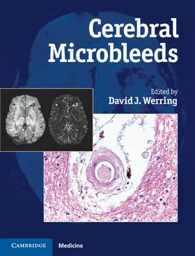 Werring |  Cerebral Microbleeds | Buch |  Sack Fachmedien