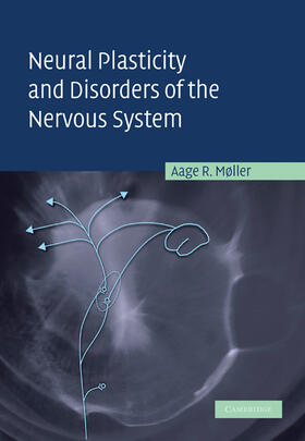 Moller / Møller |  Neural Plasticity and Disorders of the Nervous System | Buch |  Sack Fachmedien