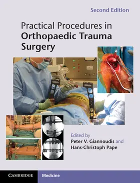 Giannoudis / Pape |  Practical Procedures in Orthopaedic Trauma Surgery | Buch |  Sack Fachmedien