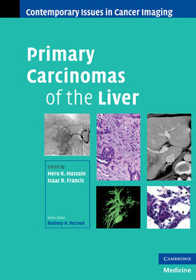 Hussain / Francis |  Primary Carcinomas of the Liver | Buch |  Sack Fachmedien