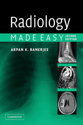 Banerjee |  Radiology Made Easy | Buch |  Sack Fachmedien