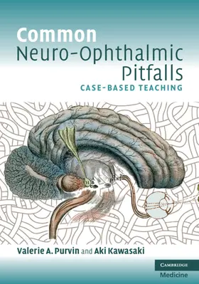 Purvin / Kawasaki |  Common Neuro-Ophthalmic Pitfalls | Buch |  Sack Fachmedien