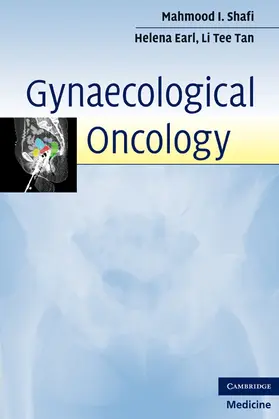 Shafi / Earl / Tan |  Gynaecological Oncology | Buch |  Sack Fachmedien