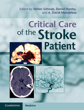 Schwab / Hanley / Mendelow |  Critical Care of the Stroke Patient | Buch |  Sack Fachmedien