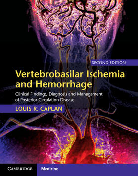 Caplan |  Vertebrobasilar Ischemia and Hemorrhage | Buch |  Sack Fachmedien