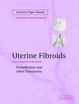 Tulandi |  Uterine Fibroids | Buch |  Sack Fachmedien