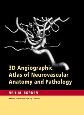 Borden |  3D Angiographic Atlas of Neurovascular Anatomy and Pathology | Buch |  Sack Fachmedien
