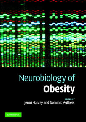 Harvey / Withers |  Neurobiology of Obesity | Buch |  Sack Fachmedien