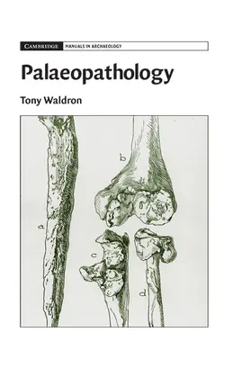 Waldron |  Palaeopathology | Buch |  Sack Fachmedien