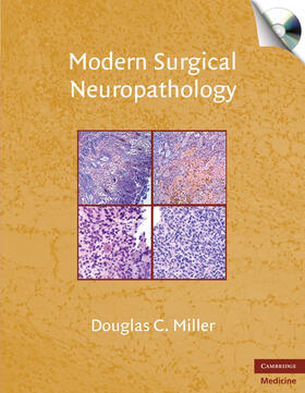 Miller |  Modern Surgical Neuropathology | Buch |  Sack Fachmedien