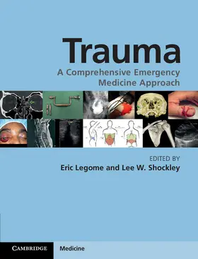 Legome / Shockley |  Trauma | Buch |  Sack Fachmedien