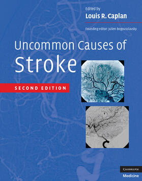 Caplan / Bogousslavsky |  Uncommon Causes of Stroke | Buch |  Sack Fachmedien