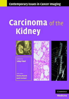 Patel |  Carcinoma of the Kidney | Buch |  Sack Fachmedien