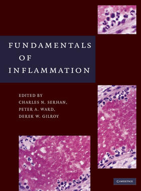 Serhan / Ward / Gilroy |  Fundamentals of Inflammation | Buch |  Sack Fachmedien