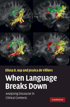 Asp / de Villiers |  When Language Breaks Down | Buch |  Sack Fachmedien