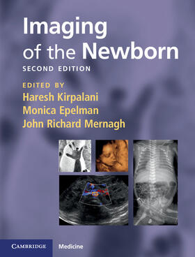 Kirpalani / Epelman / Mernagh |  Imaging of the Newborn | Buch |  Sack Fachmedien
