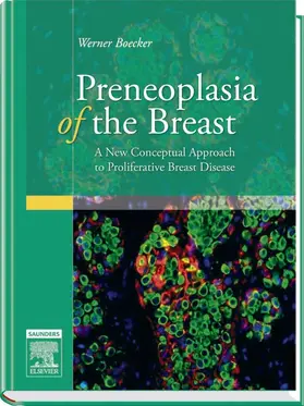 Böcker |  Preneoplasia of the Breast: A New Conceptual Approach to Proliferative Breast Disease | Buch |  Sack Fachmedien