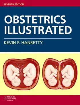 Hanretty |  Obstetrics Illustrated | Buch |  Sack Fachmedien