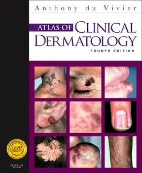 du Vivier |  Atlas of Clinical Dermatology | Buch |  Sack Fachmedien