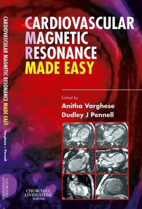 Varghese MBBS / Varghese / Pennell MD |  Cardiovascular Magnetic Resonance Made Easy | eBook | Sack Fachmedien