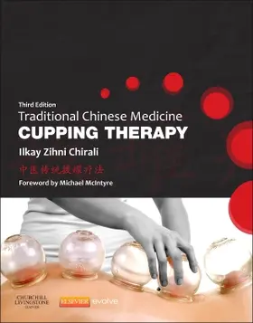 Chirali |  Traditional Chinese Medicine Cupping Therapy | Buch |  Sack Fachmedien