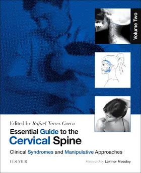 Torres Cueco |  Essential Guide to the Cervical Spine - Volume Two | Buch |  Sack Fachmedien