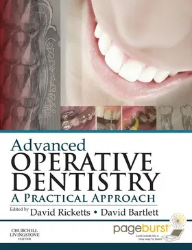 Ricketts BDS Hons / Ricketts |  Advanced Operative Dentistry | eBook | Sack Fachmedien