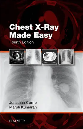 Corne / Kumaran |  Chest X-Ray Made Easy E-Book | eBook | Sack Fachmedien